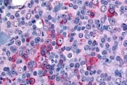 NANP Antibody, Novus Biologicals 50 &mu;g; Unconjugated:Antibodies, Polyclonal
